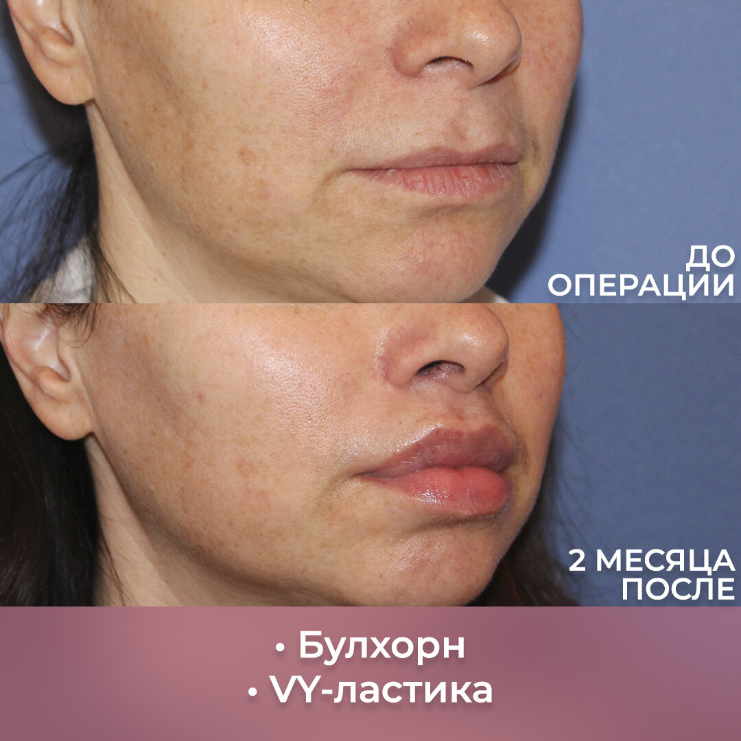 Пластический хирург: Левицкая М.Г.