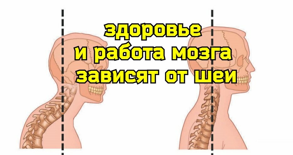 Поворот шеи вред и опасность вращения шейного отдела позвоночника