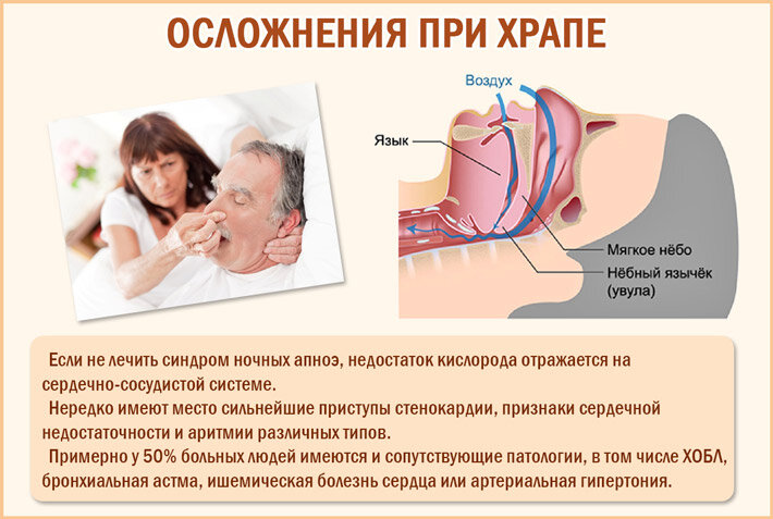 Почему ребенок храпит. Механизм храпа у человека.