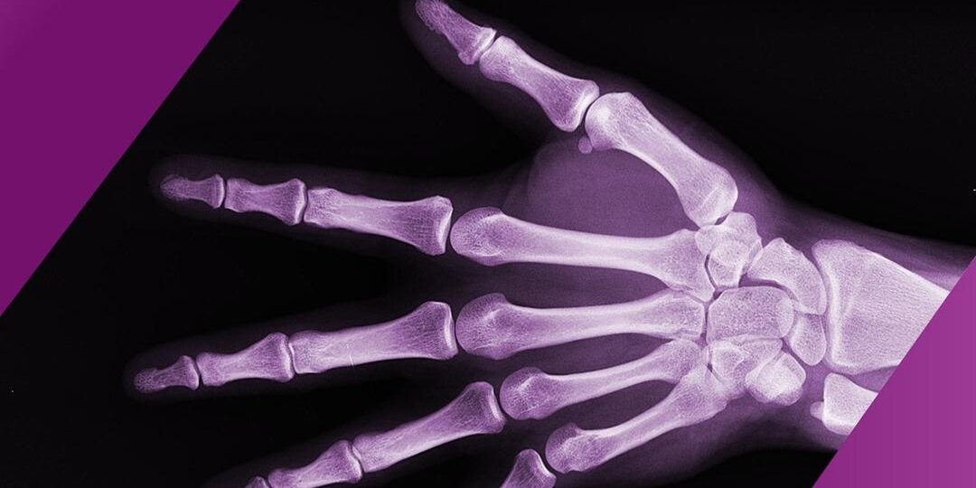 «Хрупкость» в вопросах и ответах