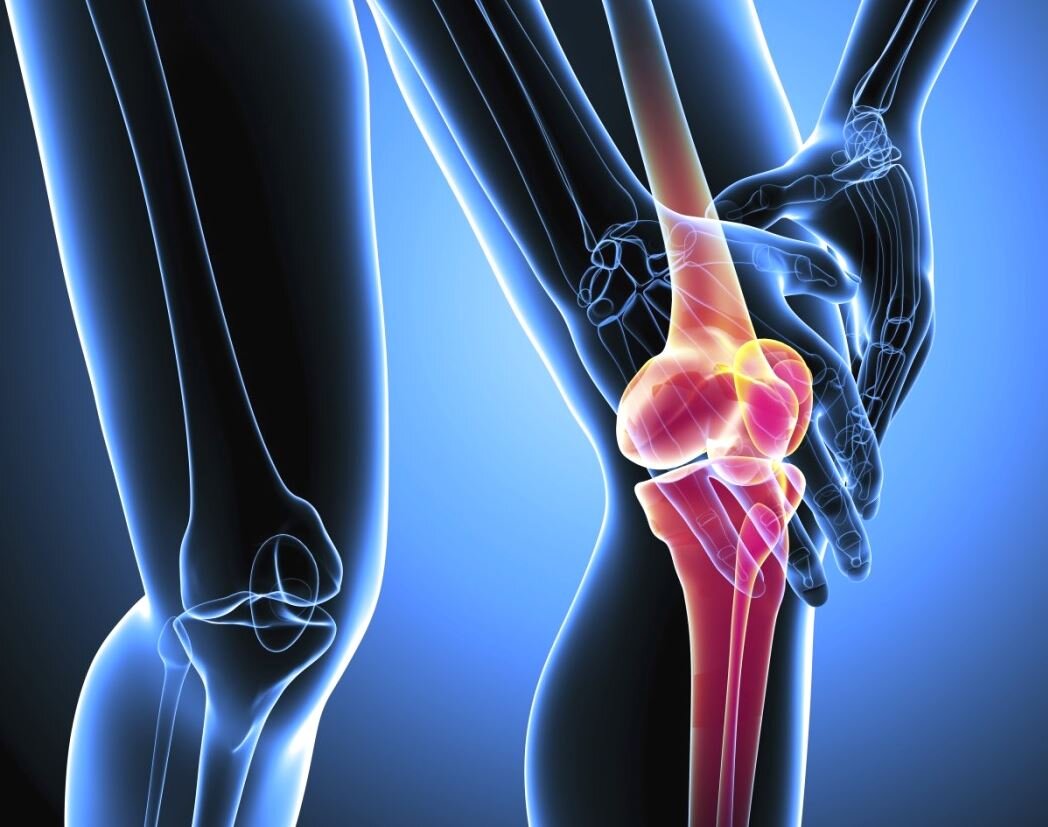 Хруст в коленях при сгибании и разгибании — причины, лечение, что делать и к какому врачу идти