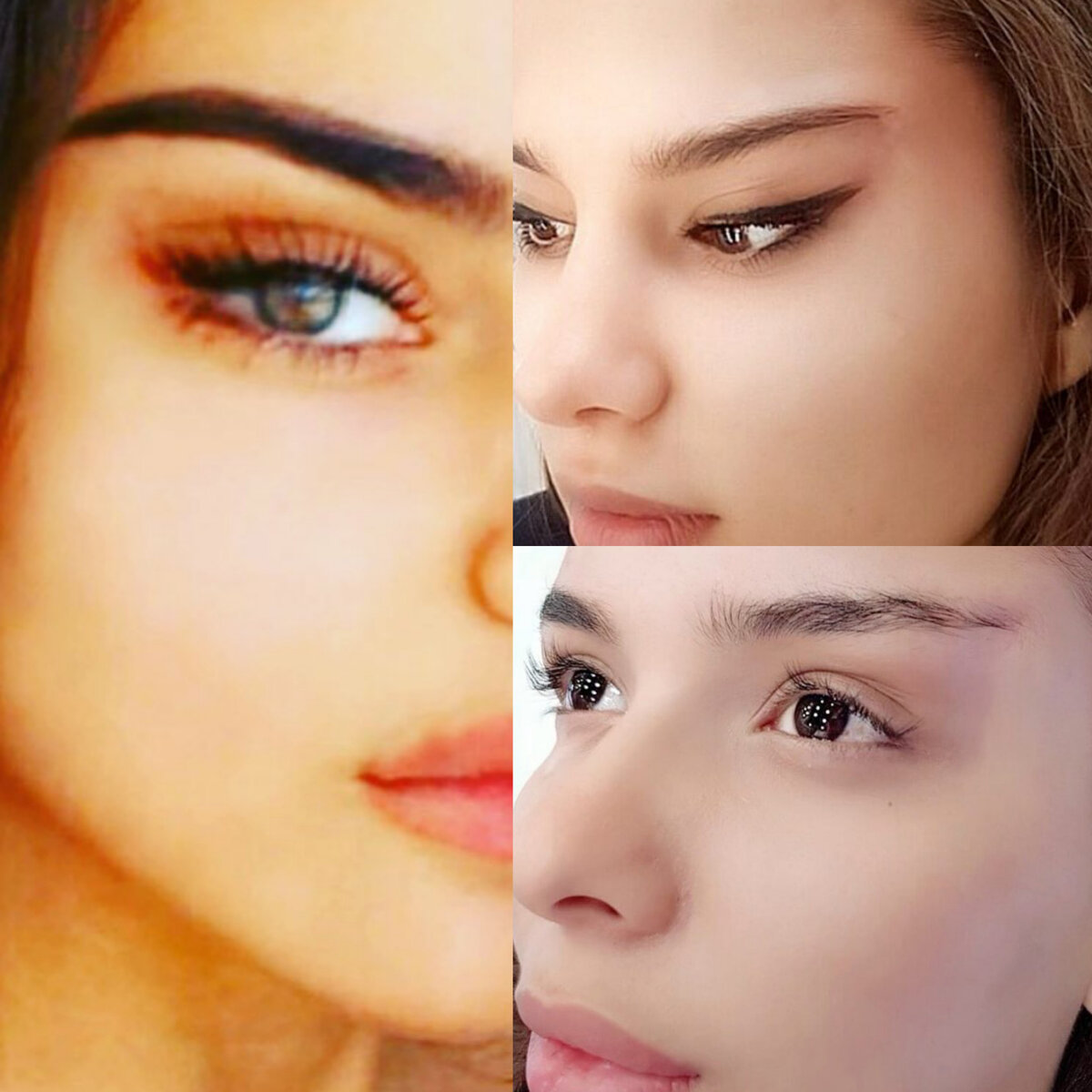 Лисьи глазки