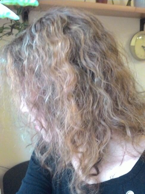 Это мои волосы до лечения 