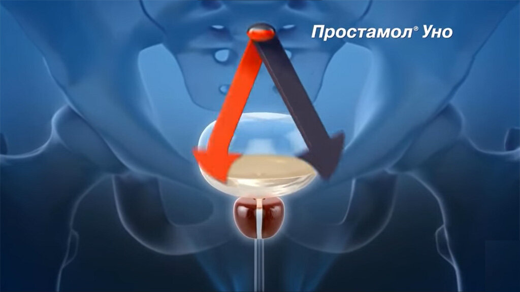 Кадр из рекламного ролика «Простамол Уно - Просто будь мужчиной!»