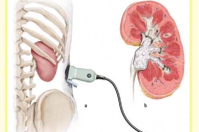    Фото: Из архива/  ОКБ Тверь