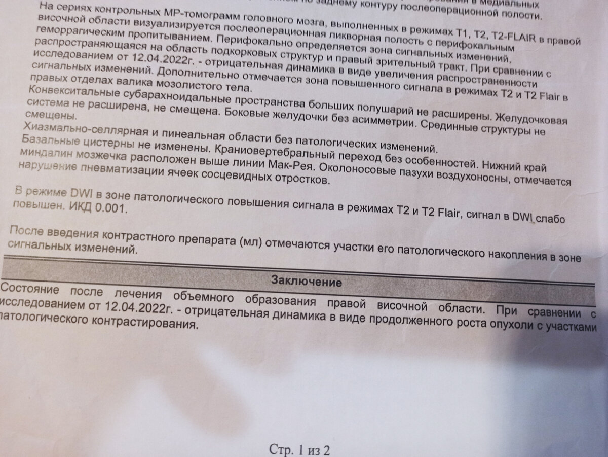 Рак мозга 4 степени. Глиобластома. Отчёт о житие и контрольное МРТ. |  Алексей Галкин | Дзен