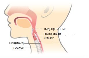
Разновидности
