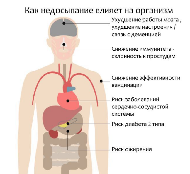 Какие бывают риски из-за недосыпания?