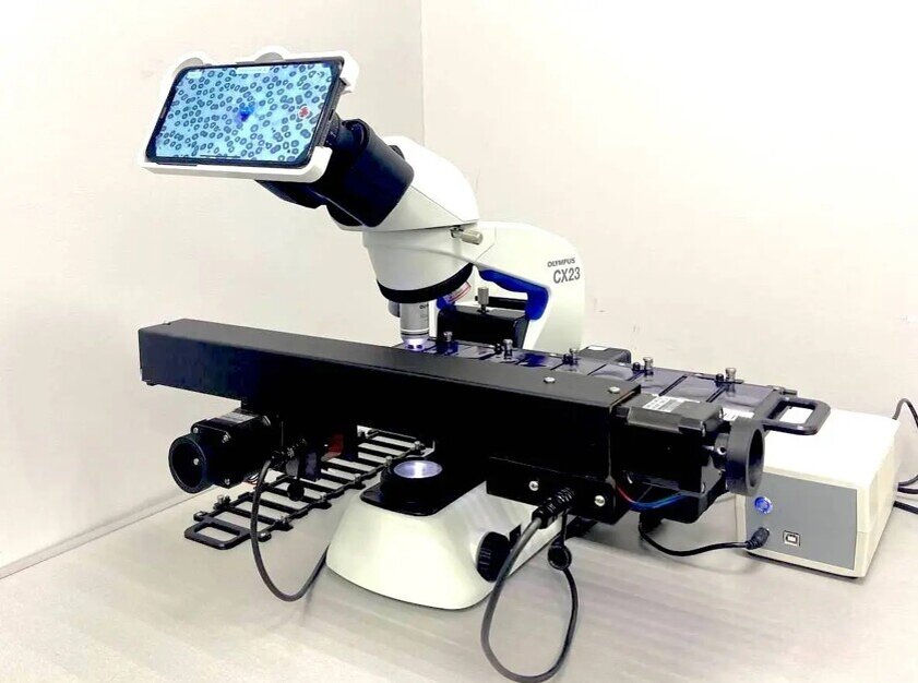    Айфон, подключенный к микроскопу / Источник: Celly.AI