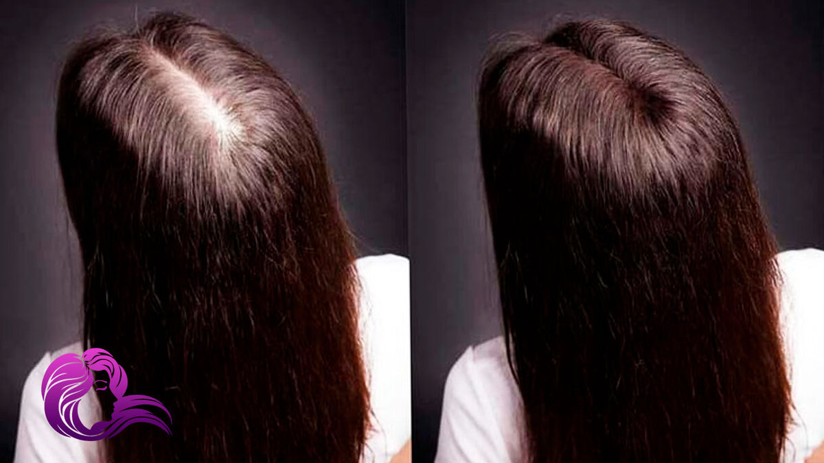 Для роста волос. Ламинирование волос в салоне. Ламинирование волос доти после. Как понять густые волосы или нет. Как понять густые волосы или нет.