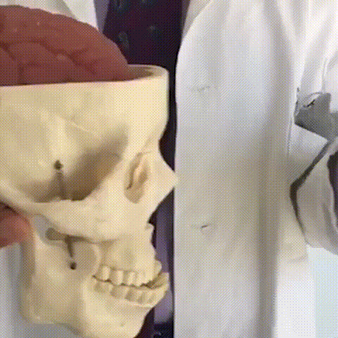 Моделирование проведения мозга при ударе. 