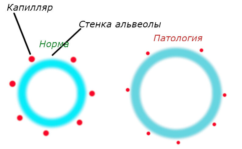Для наглядности капилляров изображено всего несколько