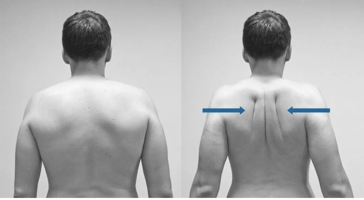 Почему левое ниже правого. Правильная спина. Ровный позвоночник. Сведение лопаток упражнение.