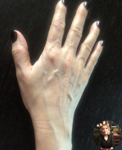 Доказательство действенности противопигментных кремов :)