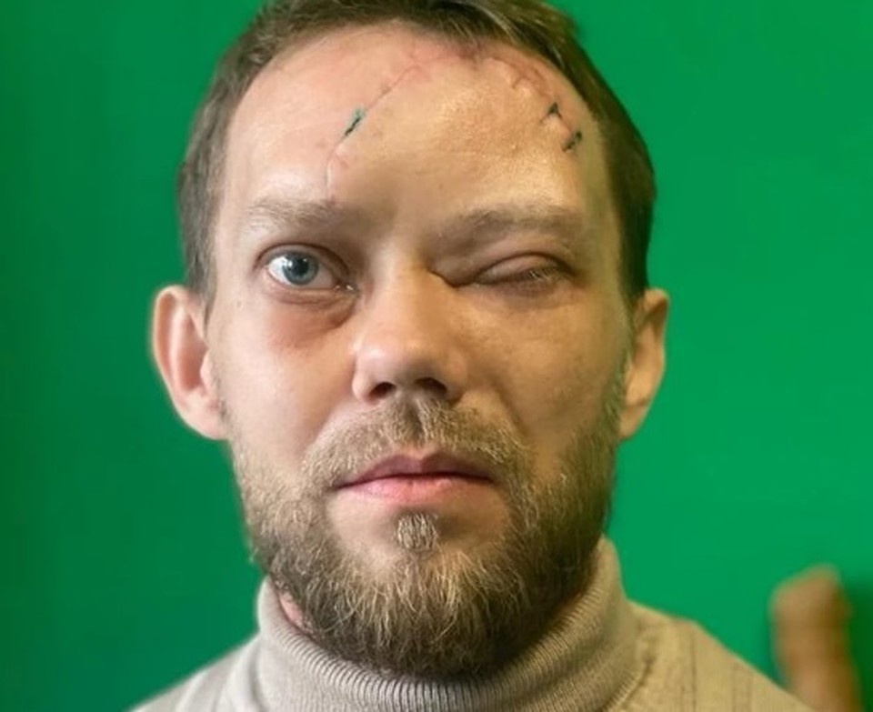     Так Сергей выглядел, когда приехал за медпомощью в Краснодар