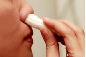 Если не удалось остановить носовое кровотечение, применяя предыдущие приемы, прибегают к изготовлению тампонов с сосудосуживающими лечебными препаратами.
 Такой способ является наиболее эффективным, если кровь из носа истекает тонкой струйкой. Сворачивают марлевую турунду. Использовать вату для этих целей нецелесообразно, так как она быстро разбухает и могут возникнуть сложности с ее извлечением. Пропитывают получившийся тампон сосудосуживающими каплями, предназначенными для закапывания в носовые ходы, о поместить в пораженную ноздрю. Кончик длиной не менее 2 см должен оставаться снаружи. Спустя четверть часа для облегчения извлечения капают это же средство на торчащую из носа марлю, размягчая ее, и осторожно извлекают.
 Чтобы справиться с кровотечением, вместо сосудосуживающих лекарственных препаратов можно воспользоваться трехпроцентной перекисью водорода. Алгоритм действий аналогичен предыдущему описанию.
 Среди неотложных мер при кровотечениях из носовых проходов у детей или у взрослых отмечается обеспечение постоянного поступления в комнату свежего воздуха. Это позволит предупредить появление головокружений, часто сопровождающих ситуацию с истечением крови из носа.
 Оказывая дома первую доврачебную помощь, следует внимательно контролировать состояние больного. Если после апробованных мер через 20 минут не наблюдается положительного результата, то вызывают скорую медицинскую помощь или самостоятельно отвозят пострадавшего в лечебное учреждение.