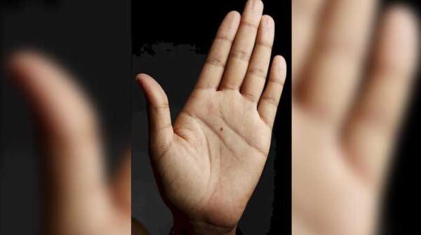 Родинки на ладони: значение и таинственные предсказания