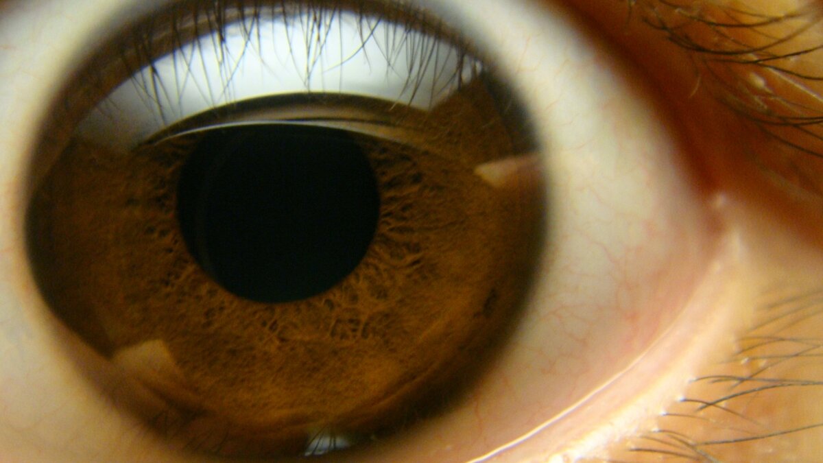 Почему карий цвет глаз самый распространенный. 