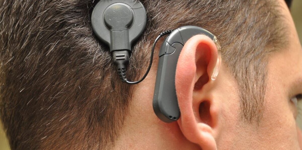 Может ли искусственное ухо заменить родное? - Центр реабилитации слуха «Счастливое ухо»