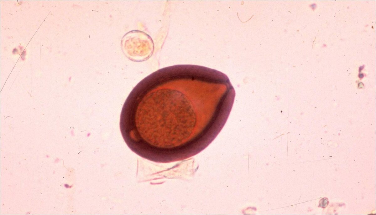 trichuris trichiura яйца