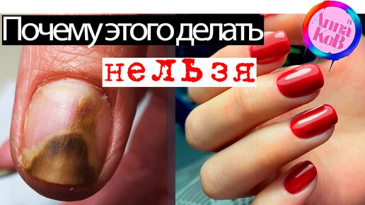 А Вы знали ЭТО? ОНИХОЛИЗИС 🥵 И Укрепление ногтей полигелем