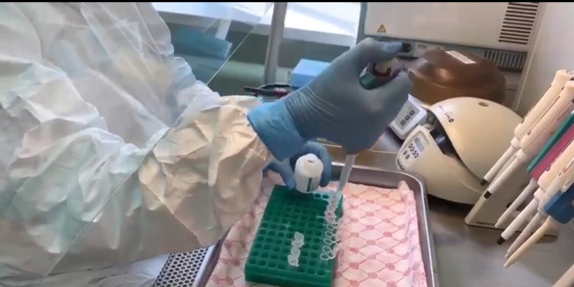 Проведение исследований на COVID-19