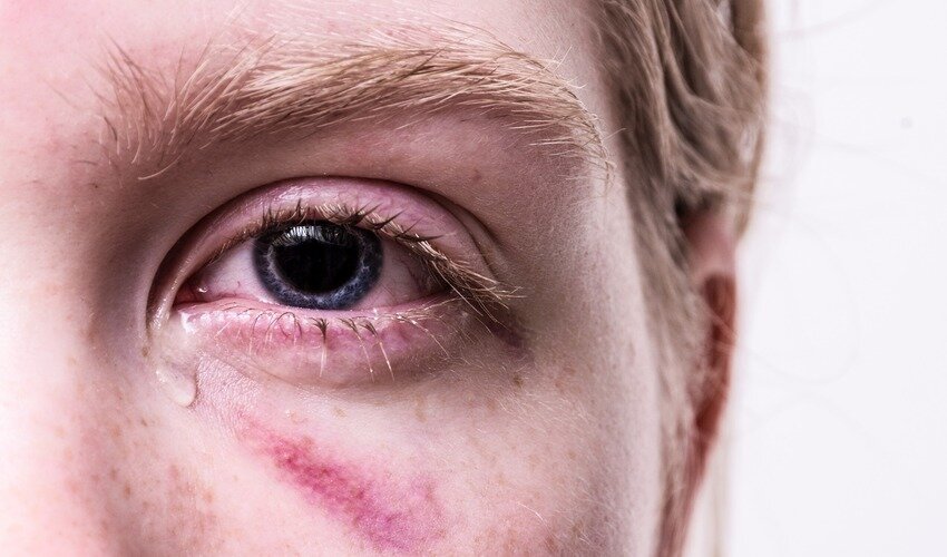 Фото: pixabay.com