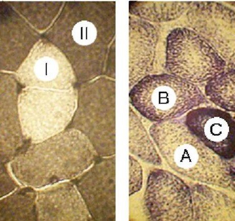 Рис. 2. Поперечный срез скелетной мышцы с волокнами, проявляющими различную ферментативную активность (из открытых источников с изменениями): I- быстрое волокно
II - медленное волокно
А - быстрое (гликолитическое) волокно
В - промежуточное (окислительно-гликолитическое) волокно
С - медленное (окислительное) волокно 
