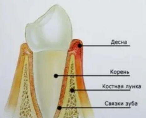 Корни зубов окружены комплексом тканей, которые надежно удерживают их в челюстной кости. Если по каким-то причинам эти ткани разрушаются, зуб расшатывается, а в сложных случаях — даже выпадает.-2