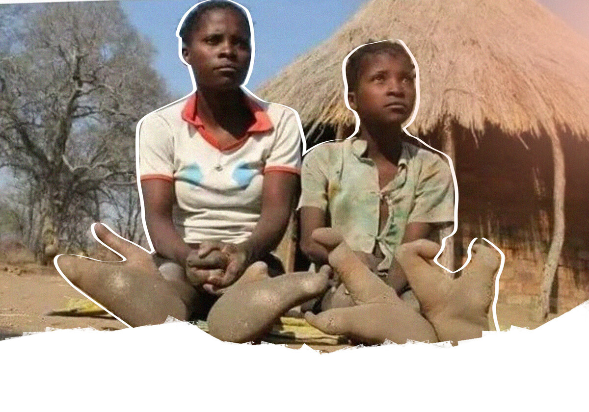 Откуда ноги растут: история двупалых — загадочного племени «‎людей-страусов»