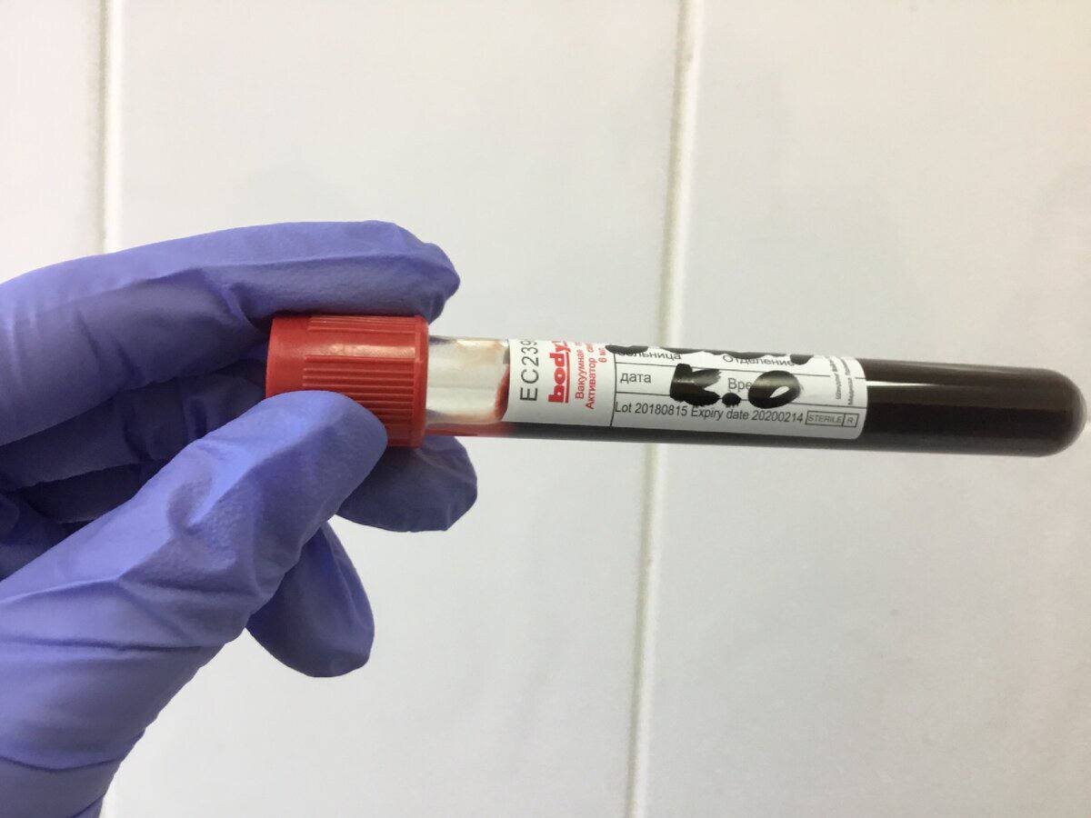 По итогам октября, число выявленных случаев сифилиса на 38% и 129% превысило показатель за тот же месяц 2021 и 2020 года соответственно. 

По Москве заболеваемость в 4,6 раза выше среднероссийской. 