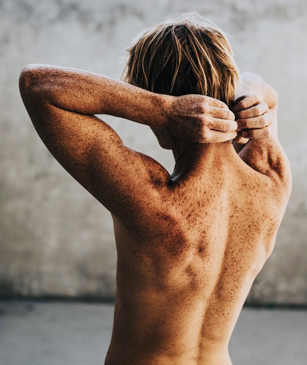 Рак кожи❗️