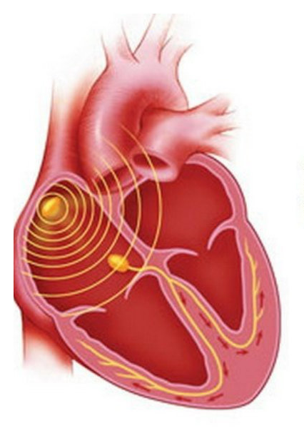 Синусовый узел 