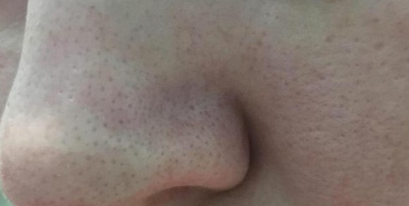 Моя кожа до нанесения маски.