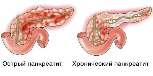 А чем питаться то доктор?