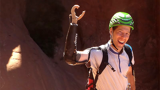 Не смотря на потерю руки, он остается счастливым.