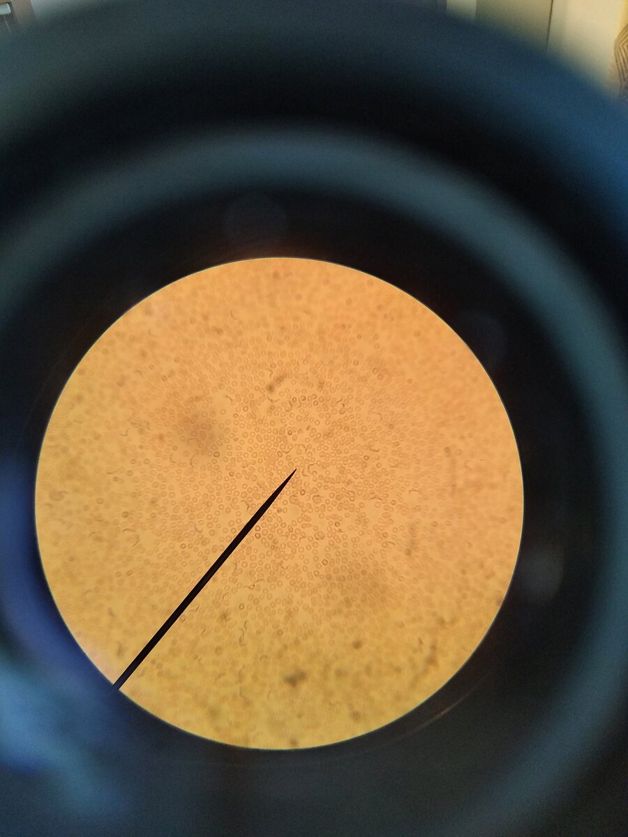 Трипаносома (Trypanosoma brucei) 