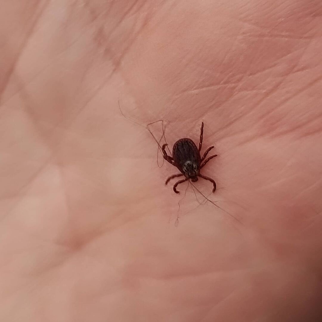 Клеща не раздавить. Я сжигаю его спичкой (фото автора)