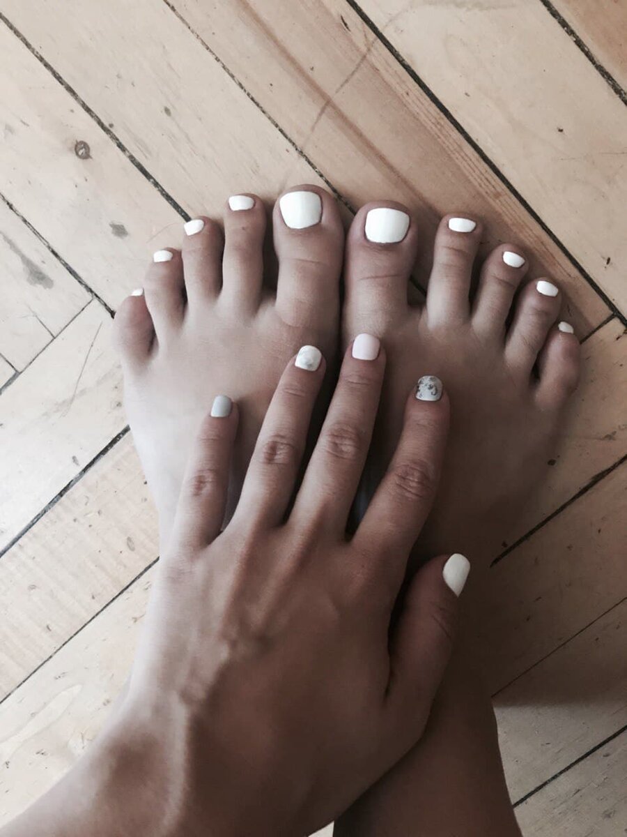 Ноготки через 2 недели после процедур, фото из личного архива