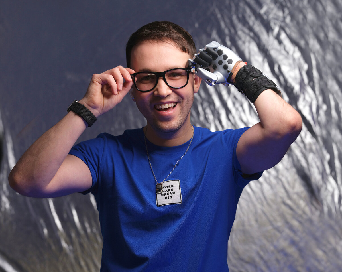 Какие виды протезов бывают? | Cyborg_M | Дзен