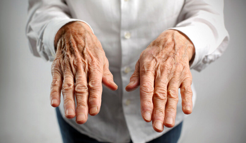 Тремор рук в пожилом возрасте. Причины тремора у пожилых | Пансионаты Опека