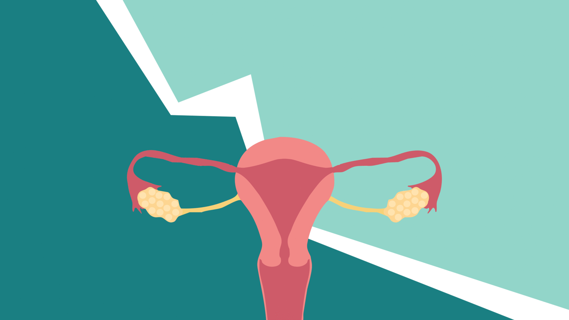 Como engrosar el endometrio