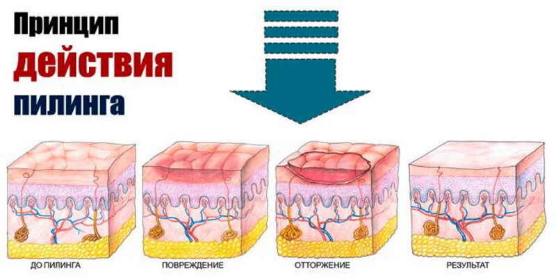 Процедура Lightening (сияние) от MediDerma