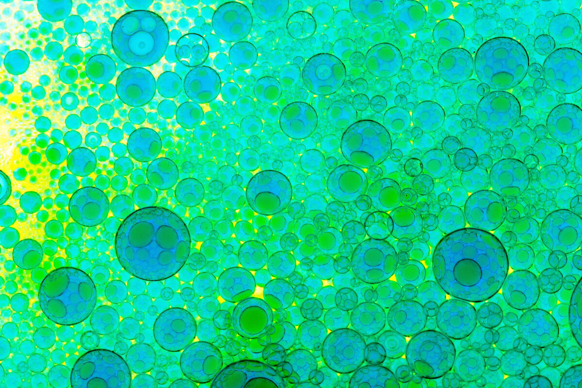 Раковые клетки отличаются от нормальных, но различия могут быть выражены в разной степени. Это и называется степенью дифференцировки. 