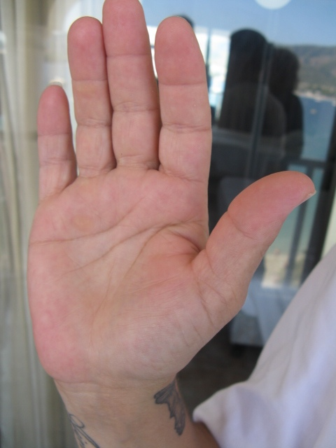 Правая рука Сары. Из личного архива.