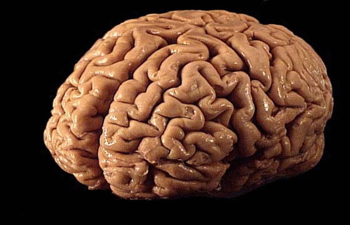 Зачем мозгу складки и извилины? | World facts (Мировые факты) | Дзен
