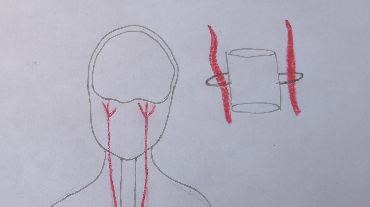Схематичное изображение кровотока затылочной области.