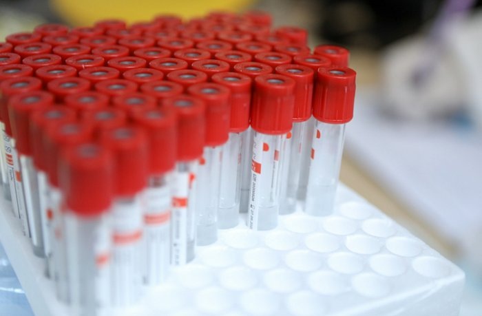 Число ежесуточно выявляемых заражений не уменьшается