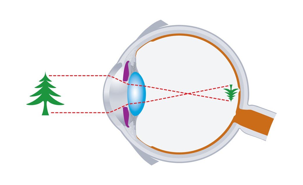 Почему видит глаз. Ход лучей в оптической системе глаза. Перевернутое изображение на сетчатке глаза. Строение глаза изображение получаемое на сетчатке глаза. Проецирование изображений на сетчатку.