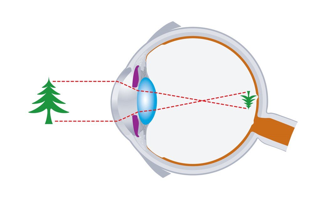 Видеть изображения на предметах. Ход лучей в оптической системе глаза. Оптическая система, проецирующая изображение. Схема оптическая система строения глаза. Изображение на сетчатке.